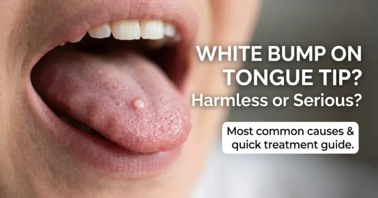 white bump on tip of tongue