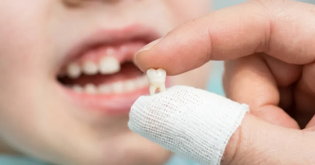 Close-up of a parent using a clean tissue to gently check a child's loose front baby tooth.