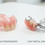 dental flipper vs partial denture